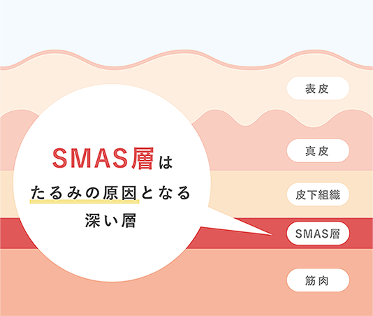 SMAS層はたるみの原因となる深い層「表皮、真皮、皮下組織、SMAS、筋肉」