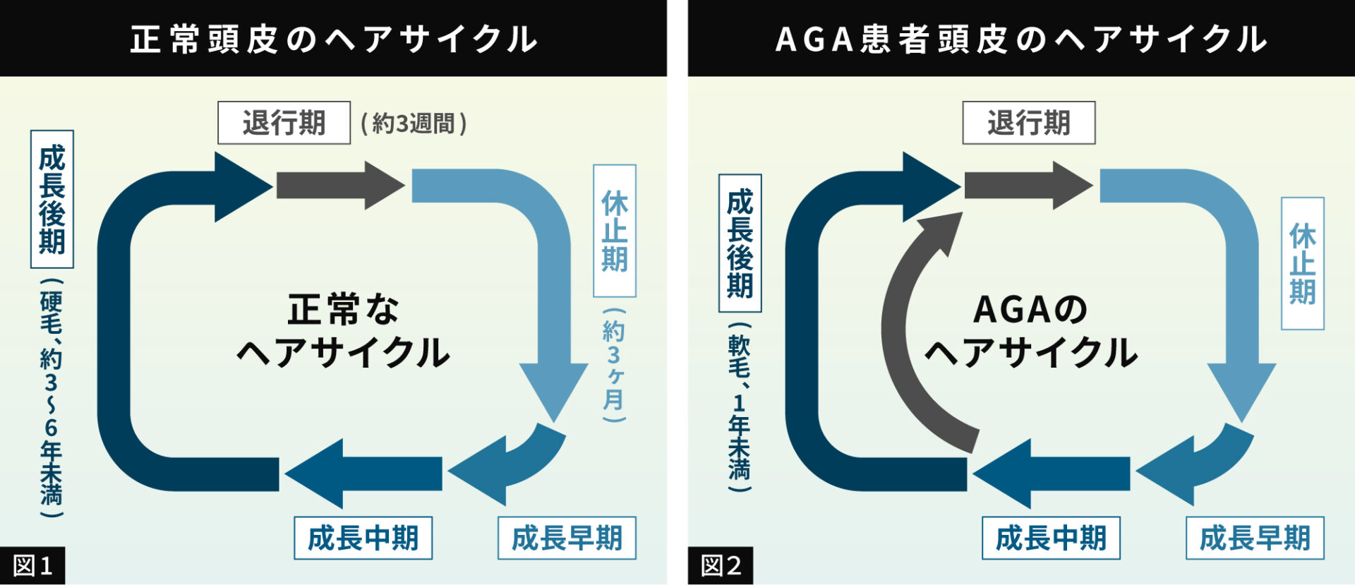 正常なヘアサイクルとAGAのヘアサイクルの比較