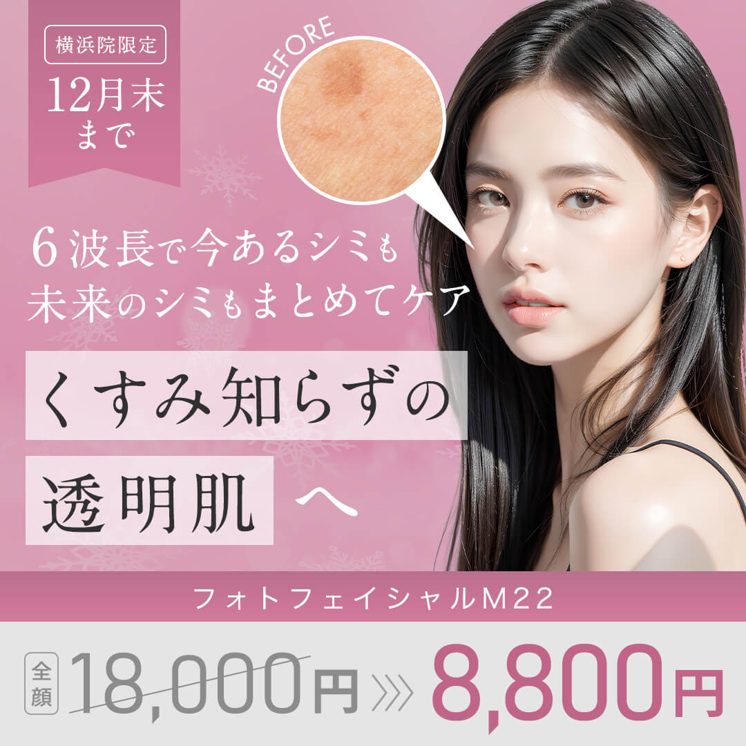 フォトフェイシャルM22_横浜院限定12月キャンペーン