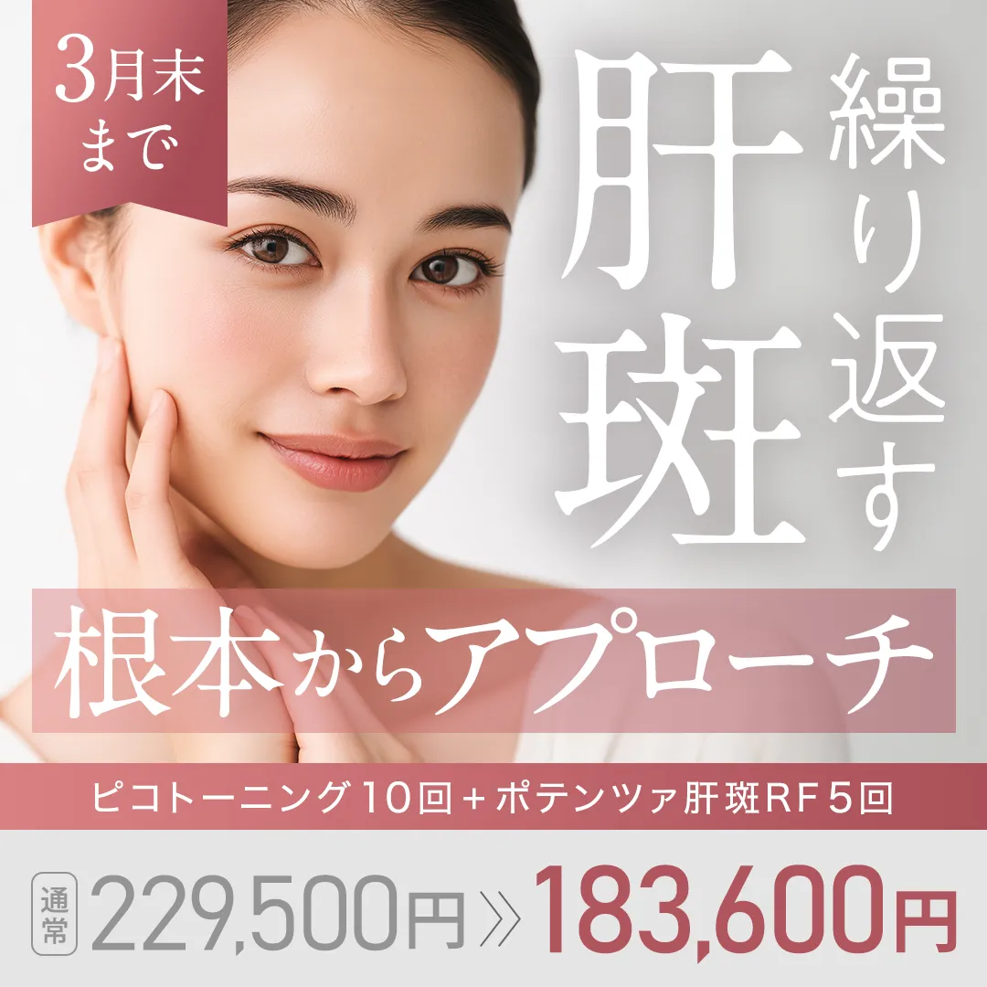 繰り返す肝斑 根本からアプローチ ピコトーニング10回+ポテンツァ肝斑RF5回「通常 229,500円→183,600円」3月末まで
