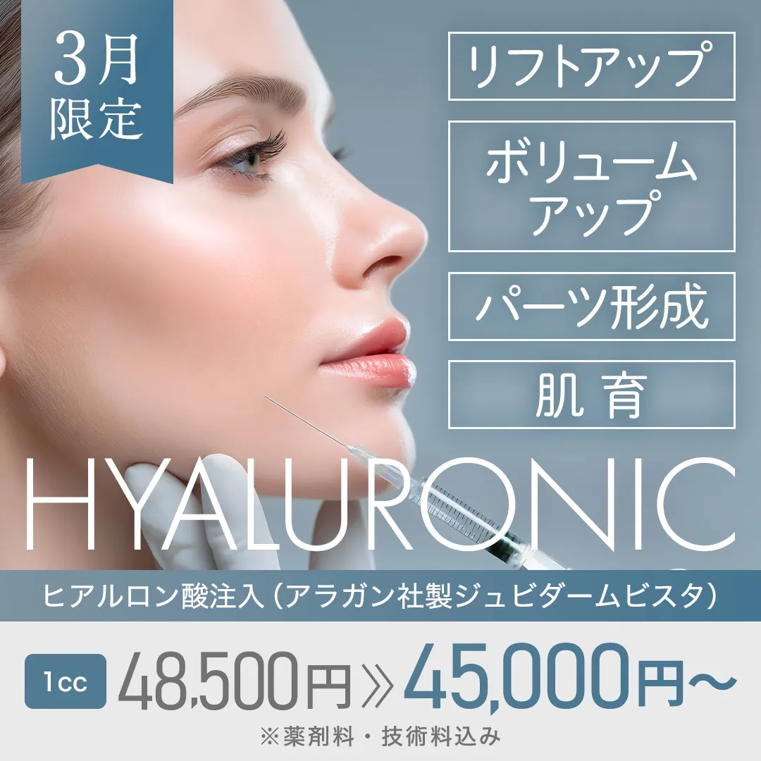 「リフトアップ、ボリュームアップ、パーツ形成、肌育」ヒアルロン酸注入(アラガン社製ジュビダームビスタ) 1cc 48,500円→45,000円~ ※薬剤料・技術料込み 3月限定