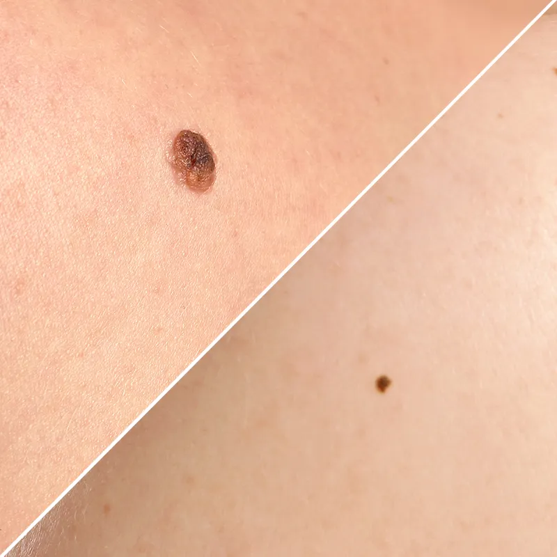 大きい・小さいタイプ